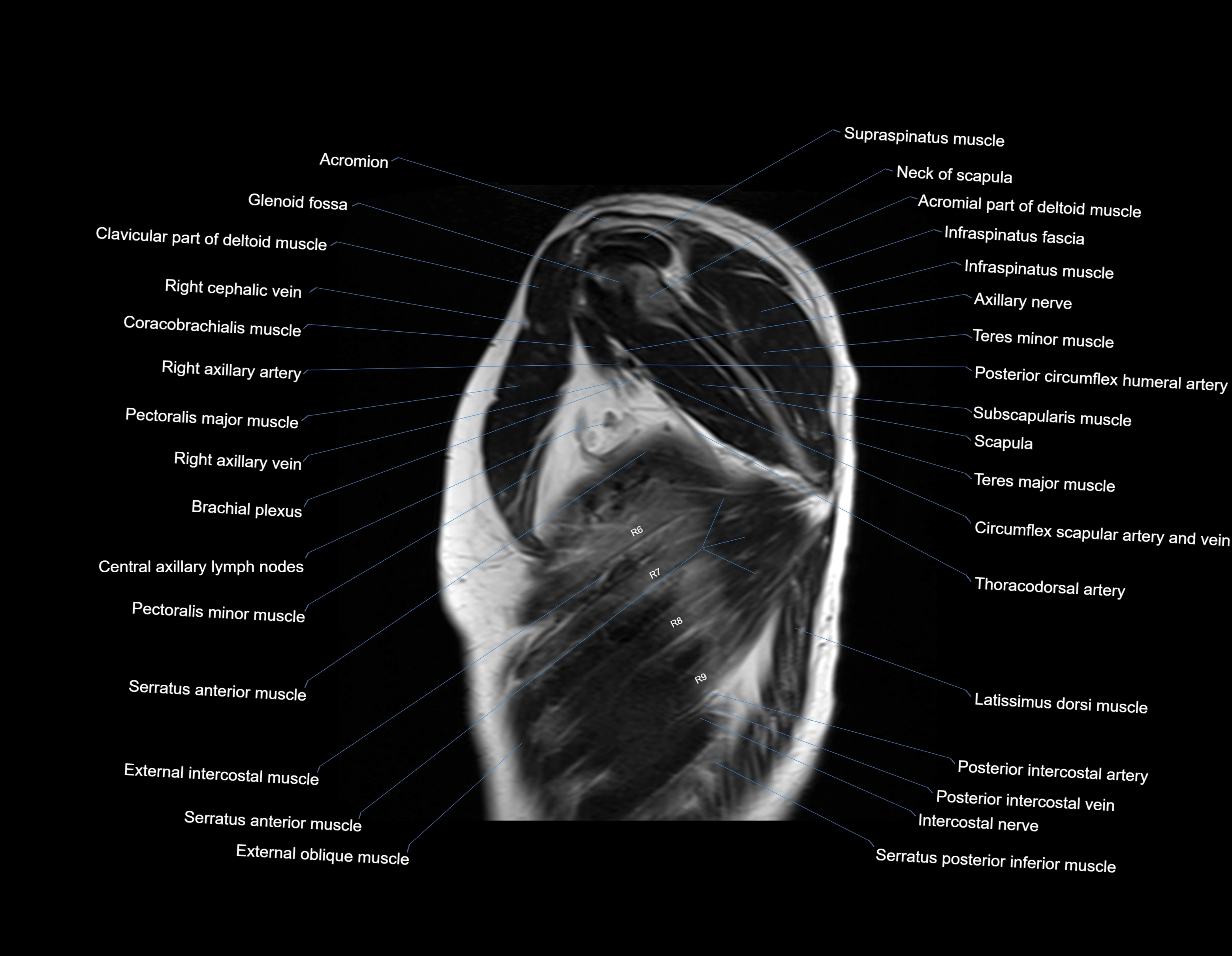 MRI chest (thorax) sagittal labelled cross sectional anatomy 3T radiology image-img-00001-00004.webp